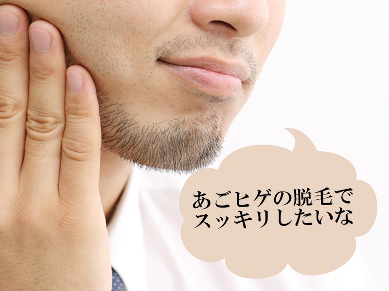 福山市の男性が抱えるあごのヒゲに関する悩み