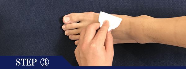 足の甲脱毛Step3