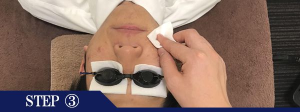 鼻下ヒゲ脱毛Step3