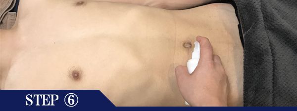 へそ脱毛Step6
