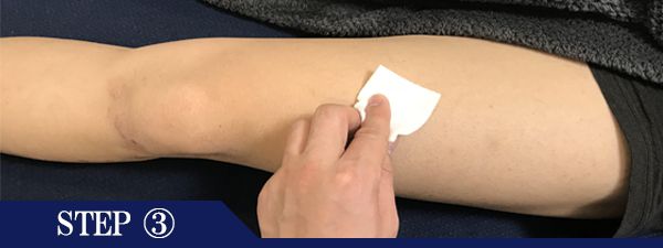 ひざ上脱毛Step3