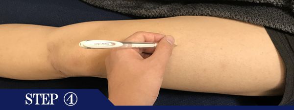 ひざ上脱毛Step4