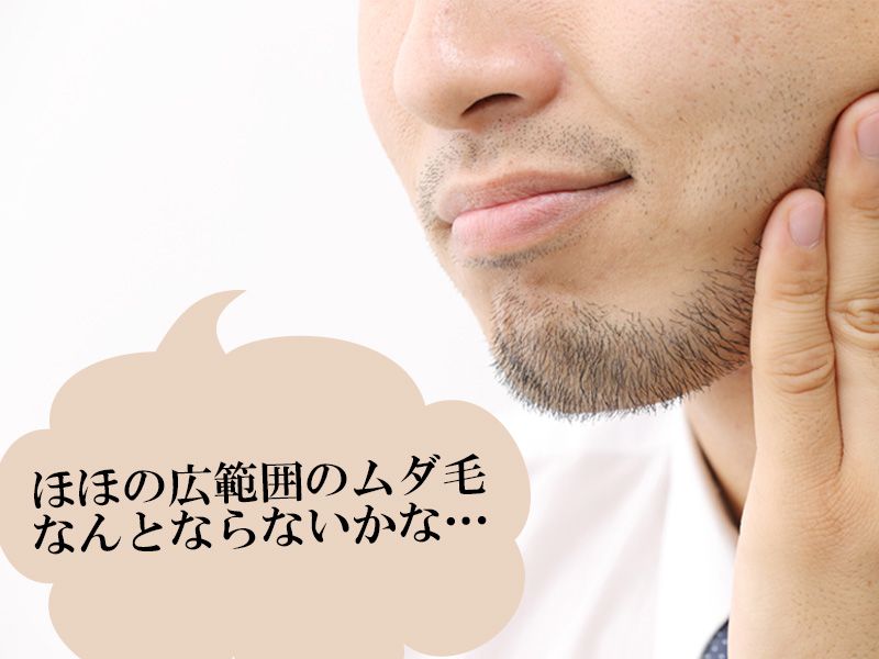 福山市の男性が抱えているほほに対するムダ毛の悩み