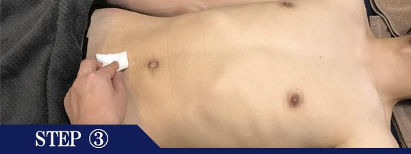 下腹部脱毛Step3