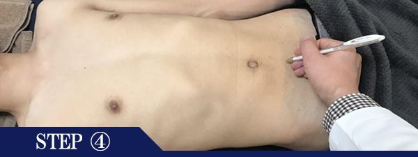 下腹部脱毛Step4