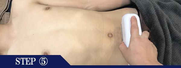 下腹部脱毛Step5
