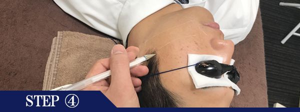 もみあげ脱毛Step4