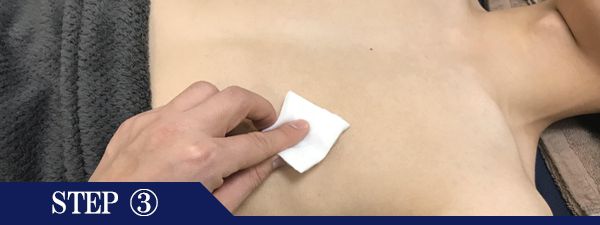 乳輪周りの脱毛Step3