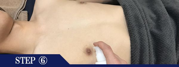 乳輪周りの脱毛Step6