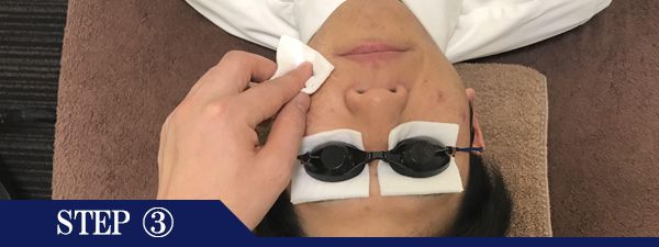 おでこ・眉間脱毛Step3