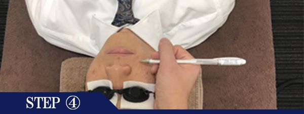 おでこ・眉間脱毛Step4