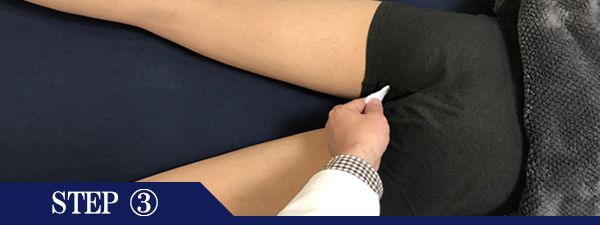 Ｏラインページ脱毛Step3