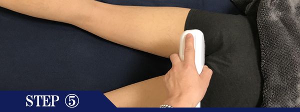 Ｏラインページ脱毛Step5