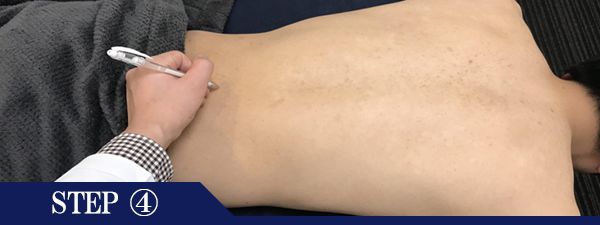 背中下脱毛Step4