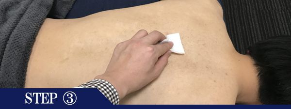 背中上脱毛Step3