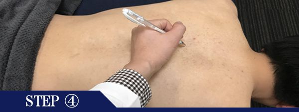 背中上脱毛Step4