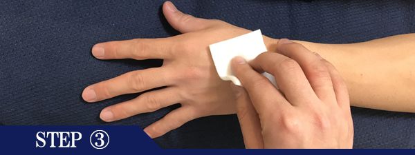 手の甲脱毛Step3