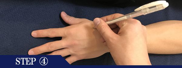 手の甲脱毛Step4