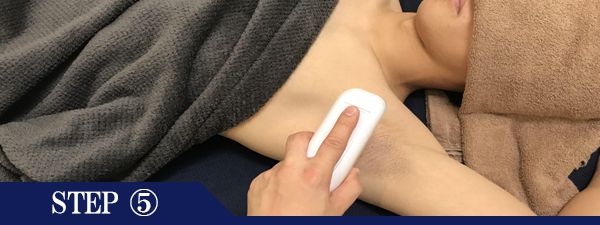 ワキ脱毛Step5